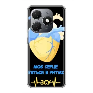 ЗСУ Чохли (TPU) для TECNO Spark 20