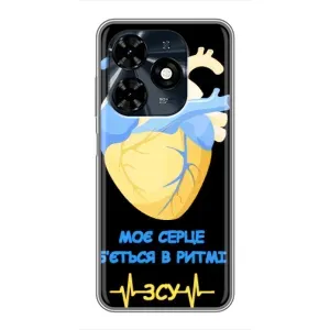 ЗСУ Чехлы (TPU) для TECNO Spark 20c