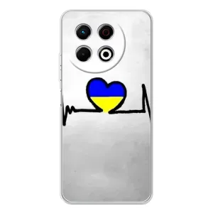 Силиконовый Чехол на TECNO Spark 30 Pro (Я-Украина) (Украинская кардиограмма)