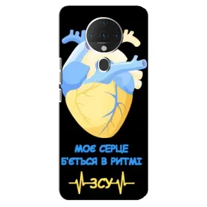ЗСУ Чехлы (TPU) для TECNO Spark 6