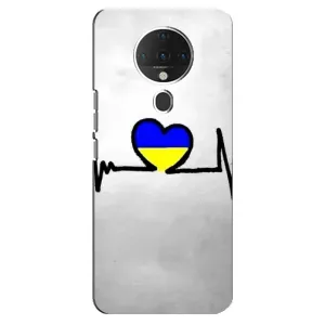 Силиконовый Чехол на TECNO Spark 6 (Я-Украина) (Украинская кардиограмма)