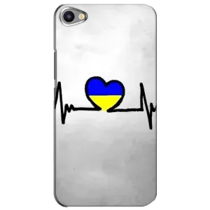 Силиконовый Чехол на Meizu U20 (Я-Украина) (Украинская кардиограмма)