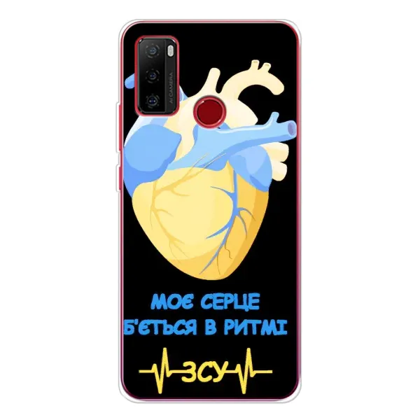Чехол с рисунком «Ритм ЗСУ» для Ulefone Note 10 Чехол с рисунком «Ритм ЗСУ» для Ulefone Note 10