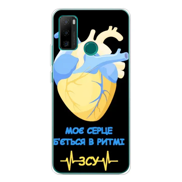 Чехол с рисунком «Ритм ЗСУ» для Ulefone Note 10P Чехол с рисунком «Ритм ЗСУ» для Ulefone Note 10P