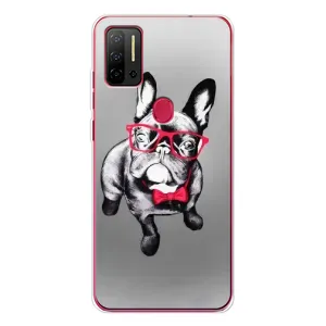 Чохол (ТПУ) Милі песики для Ulefone Note 11P (Бульдог в окулярах)
