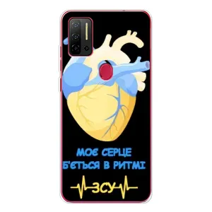 ЗСУ Чехлы (TPU) для Ulefone Note 11P