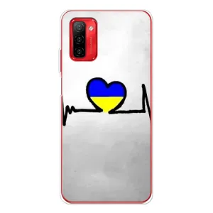 Силіконовий Чохол на Ulefone Note 12P (Я-Україна) (Українська кардіограма)
