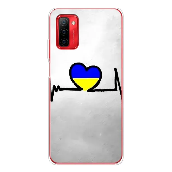 Чехол с рисунком «Украинская кардиограмма» для Ulefone Note 12P Чехол с рисунком «Украинская кардиограмма» для Ulefone Note 12P