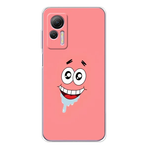 Чехол с рисунком «Мордочка Патрика» для Ulefone Note 14 Чехол с рисунком «Мордочка Патрика» для Ulefone Note 14