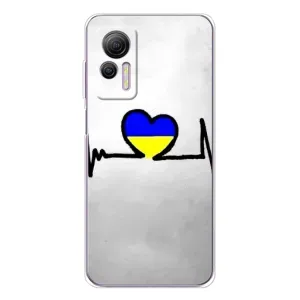 Силиконовый Чехол на Ulefone Note 14 (Я-Украина) (Украинская кардиограмма)