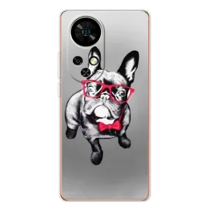 Чехол (ТПУ) Милые собачки для Ulefone Note 17 Pro (Бульдог в очках)