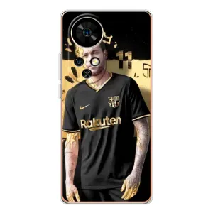 Силиконовый Чехол Ulefone Note 17 Pro (Gold Neymar)