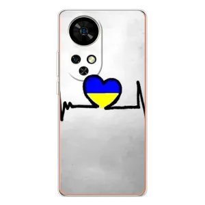 Силиконовый Чехол на Ulefone Note 17 Pro (Я-Украина) (Украинская кардиограмма)