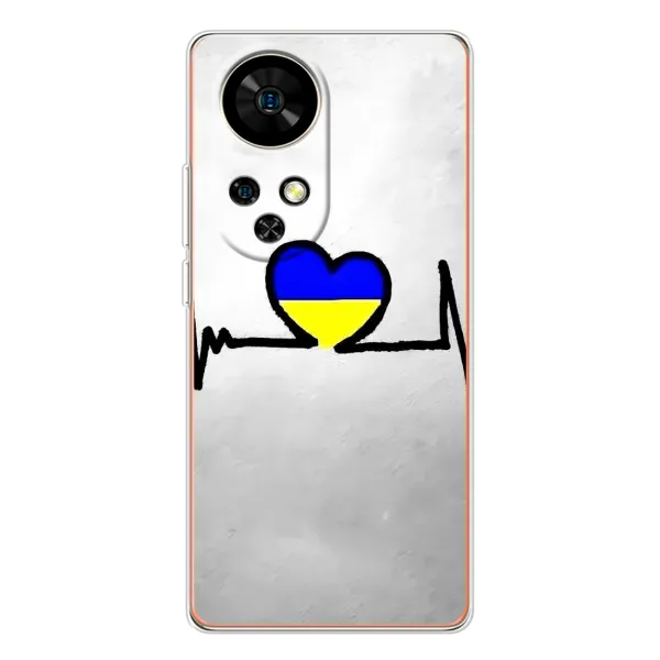 Чехол с рисунком «Украинская кардиограмма» для Ulefone Note 17 Pro Чехол с рисунком «Украинская кардиограмма» для Ulefone Note 17 Pro