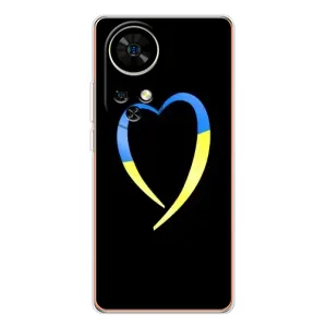Силиконовый Чехол на Ulefone Note 17 Pro (Я-Украина) (Украинское сердце)