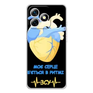 ЗСУ Чехлы (TPU) для Ulefone Note 18 Pro (Ритм ЗСУ)