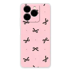 Чехол банты для Ulefone Note 20 Pro (Черные бантики)