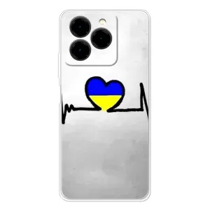 Силиконовый Чехол на Ulefone Note 20 Pro (Я-Украина) (Украинская кардиограмма)