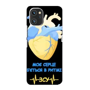 ЗСУ Чехлы (TPU) для Umidigi A13 (Ритм ЗСУ)