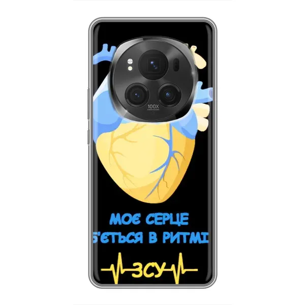 Чехол с рисунком «Ритм ЗСУ» для Vivo X200 PRO Чехол с рисунком «Ритм ЗСУ» для Vivo X200 PRO