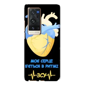 ЗСУ Чехлы (TPU) для Vivo X60 Pro Plus (Ритм ЗСУ)