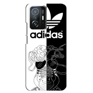 Чехол в стиле "Адидас" для Сяоми 11т / 11т про (Adidas шнурки)