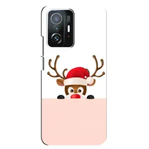 Чехол Санта Клаус для Xiaomi 11T / 11T Pro (Олененок)