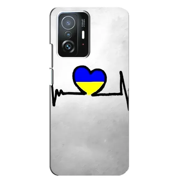 Чехол с рисунком «Украинская кардиограмма» для Xiaomi 11T / 11T Pro Чехол с рисунком «Украинская кардиограмма» для Xiaomi 11T / 11T Pro