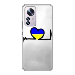 Силиконовый Чехол на Xiaomi 12 / 12X (Я-Украина) (Украинская кардиограмма)