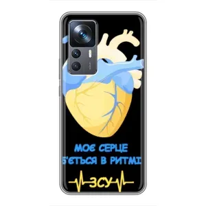 ЗСУ Чехлы (TPU) для Xiaomi 12T (Ритм ЗСУ)