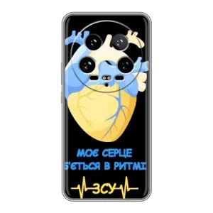 ЗСУ Чохли (TPU) для Xiaomi 14 Ultra (Ритм ЗСУ)