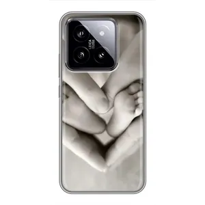 Чехол с рисунком «Любящие руки» для Xiaomi 14