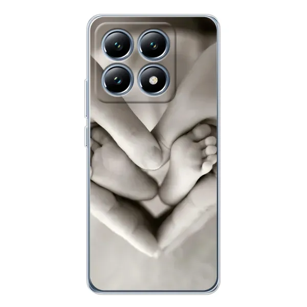 Чехол с рисунком «Любящие руки» для Xiaomi 14T Pro Чехол с рисунком «Любящие руки» для Xiaomi 14T Pro