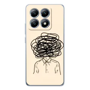 Чохли з сенсом на Xiaomi 14T Pro (Думки)