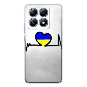 Силиконовый Чехол на Xiaomi 14T Pro (Я-Украина) (Украинская кардиограмма)