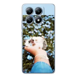 Чехлы с изображением разных животных для Xiaomi 15 Pro (Ежик на руках)
