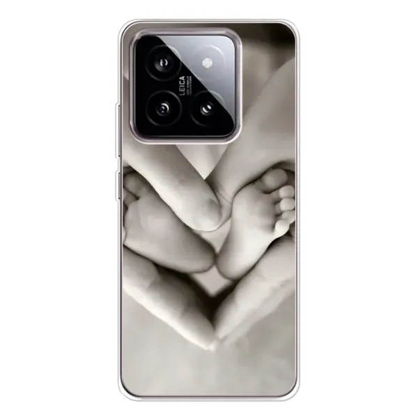 Чехол с рисунком «Любящие руки» для Xiaomi 15 Чехол с рисунком «Любящие руки» для Xiaomi 15