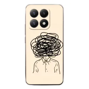 Чохли з сенсом на Xiaomi 15T (Думки)