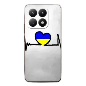 Силиконовый Чехол на Xiaomi 15T (Я-Украина) (Украинская кардиограмма)