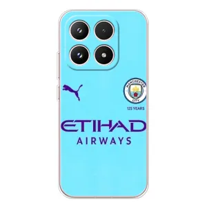 Силіконові Чохли з принтом Футбол на Xiaomi 17 (Man City)