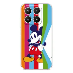 Чехлы с принтом Микки Маус на Xiaomi 17 (Яркий Микки)