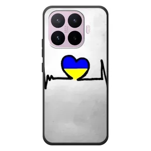 Силиконовый Чехол на Xiaomi 17T (Я-Украина) (Украинская кардиограмма)