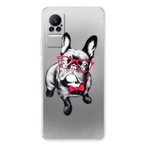 Чохол (ТПУ) Милі песики для Xiaomi Civi 1S (Бульдог в окулярах)