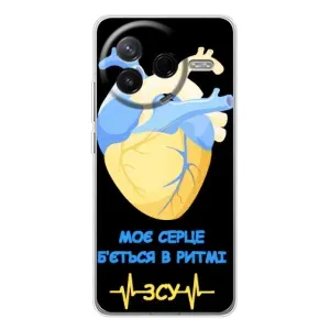 ЗСУ Чехлы (TPU) для Xiaomi Civi 4Pro (Ритм ЗСУ)