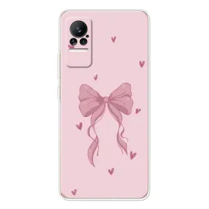Чехол банты для Xiaomi Civi (Бант на розовом)