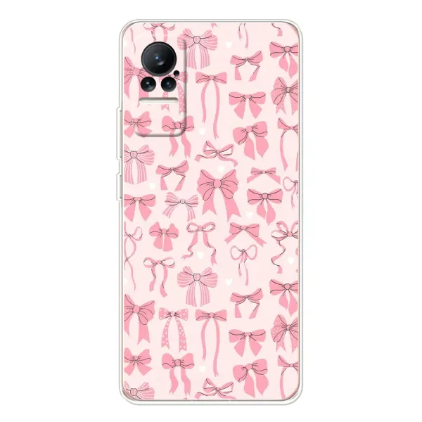 Чехол с рисунком «Фон бантики» для Xiaomi Civi Чехол с рисунком «Фон бантики» для Xiaomi Civi