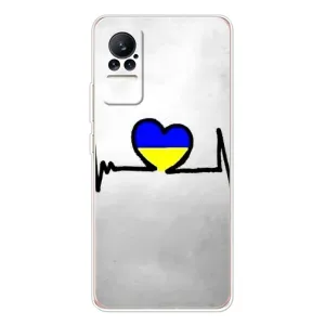 Силиконовый Чехол на Xiaomi Civi (Я-Украина) (Украинская кардиограмма)