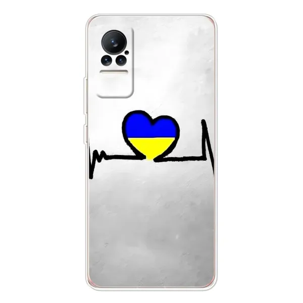 Чехол с рисунком «Украинская кардиограмма» для Xiaomi Civi Чехол с рисунком «Украинская кардиограмма» для Xiaomi Civi