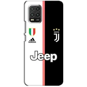 Чехлы с ТОП Футбольными клубами на Xiaomi Mi 10 Lite (Juventus)