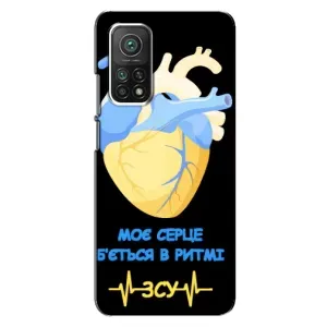 ЗСУ Чехлы (TPU) для Xiaomi Mi 10T